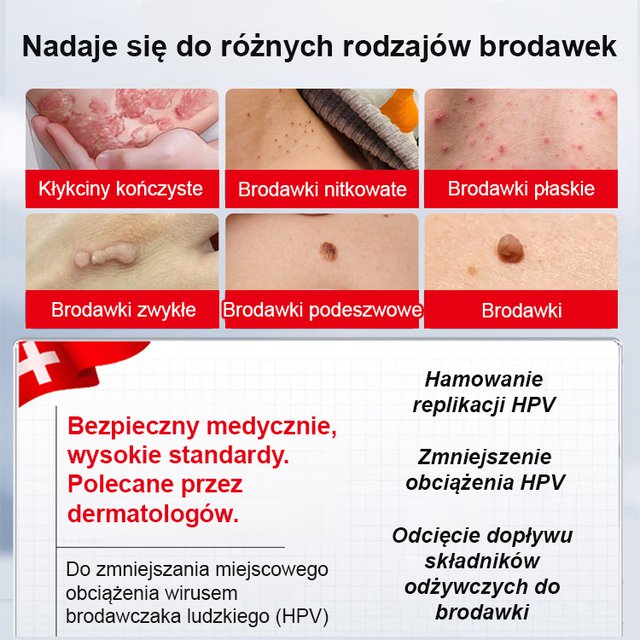 Szybko Działający Krem na Brodawki – Widoczne Efekty