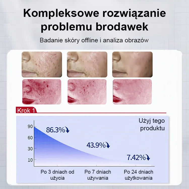 Szybko Działający Krem na Brodawki – Widoczne Efekty