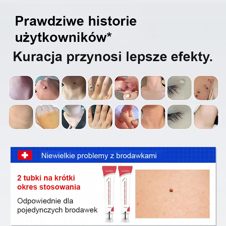 Szybko Działający Krem na Brodawki – Widoczne Efekty