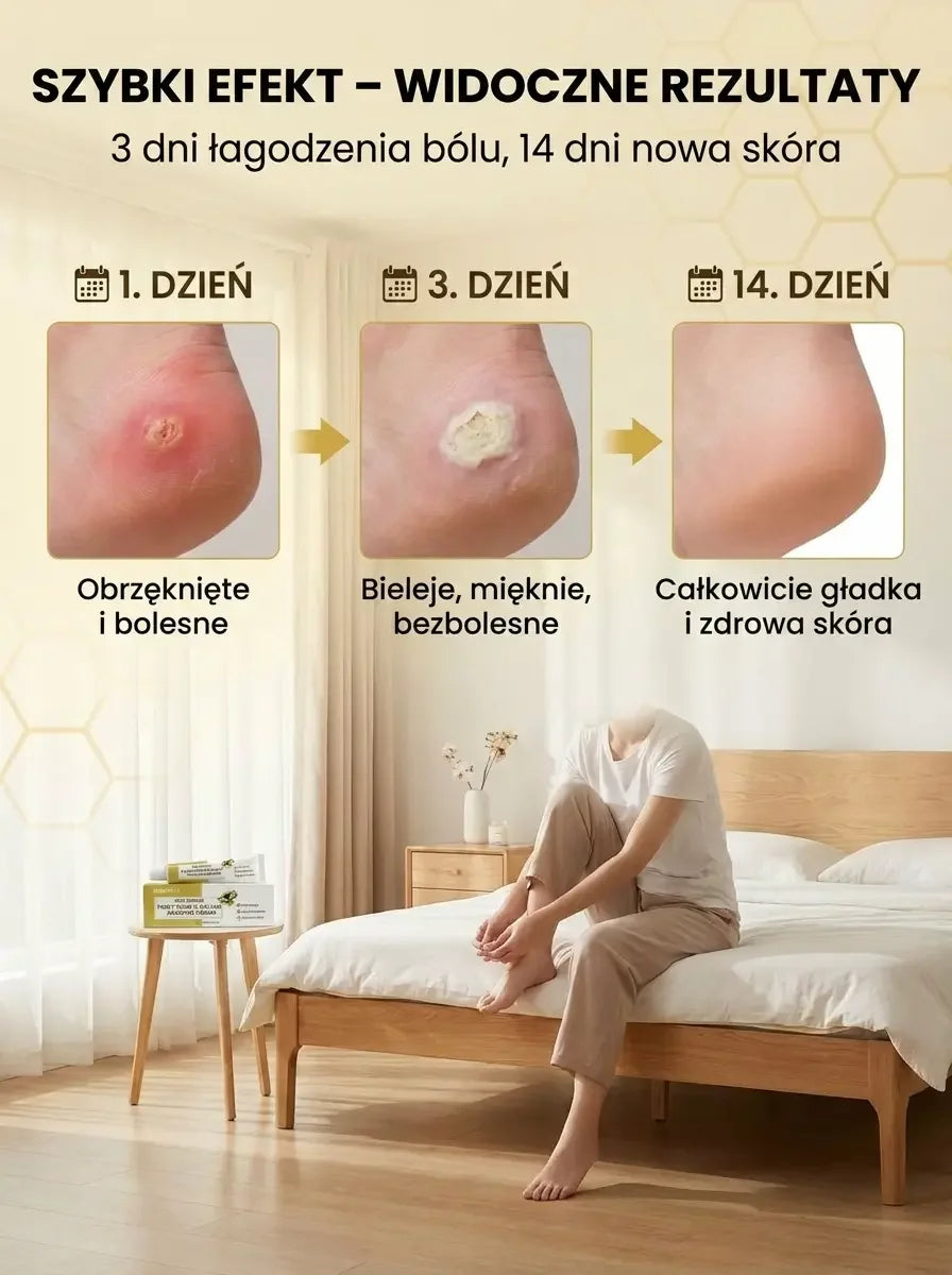 Krem na Odciski i Modzele z Jadem Pszczelim